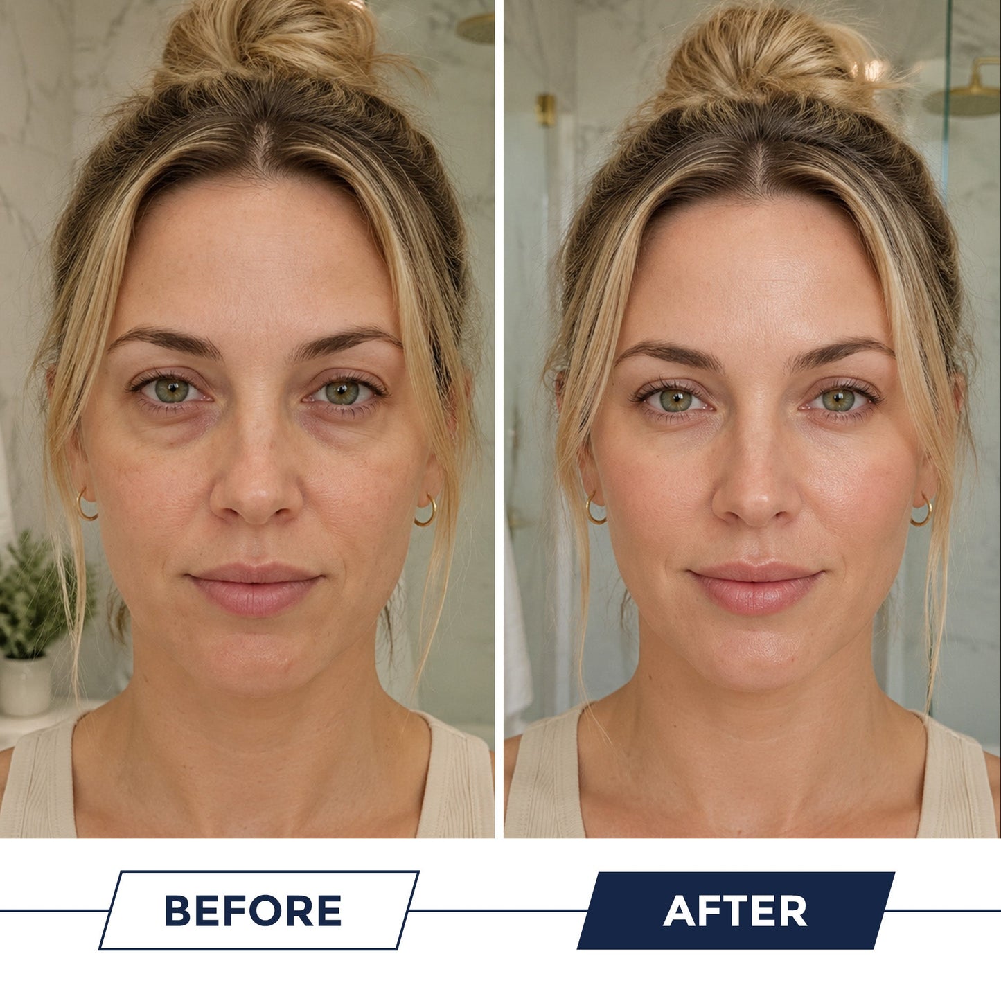 Tryskintle- Korean Under Eye Balm