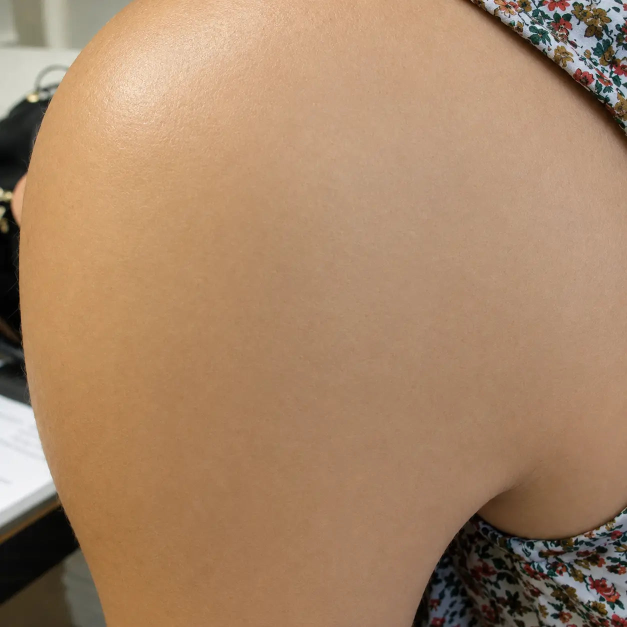 After scar treatment