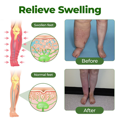 Professional Leg Circulation Cream
