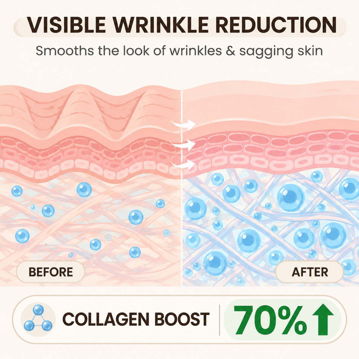 Skin elasticity skincare feature