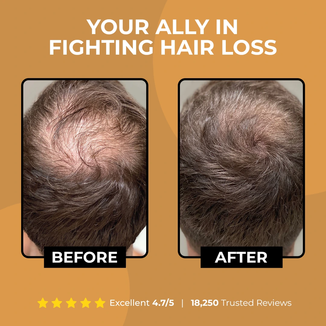 Vitaliaina Root Activator Shampoo