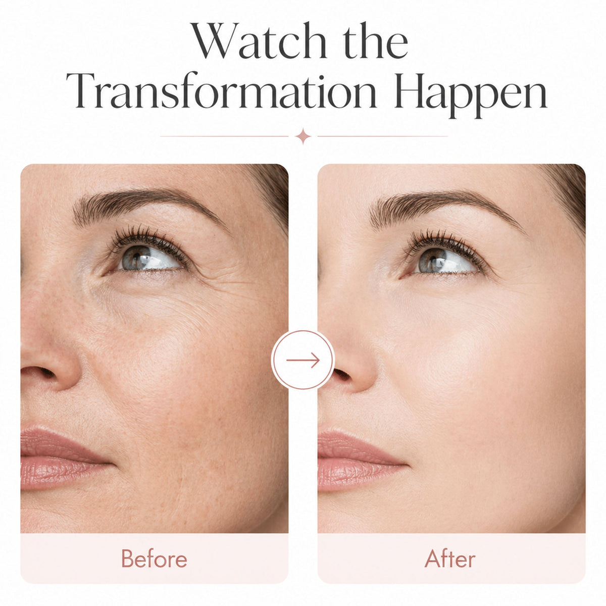 Tryskintle™ Time Reverse Cream (All-In-One)