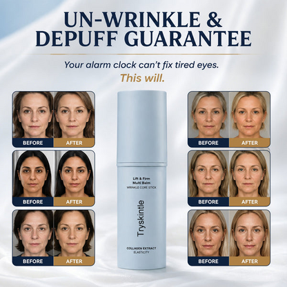 Tryskintle- Korean Under Eye Balm