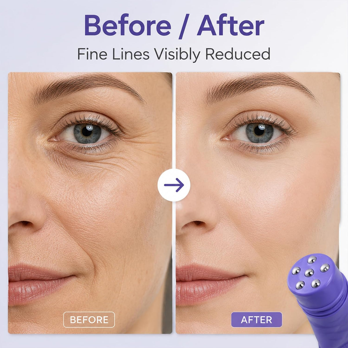 Peptide Anti-Wrinkle Roller Cream