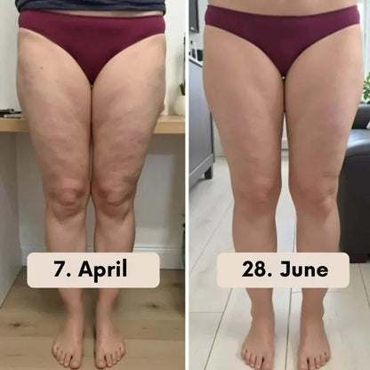 Tryskintle™ Anti-Cellulite Massage Kit