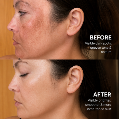 Korean Advanced Tranexamic Acid Brightening Cream