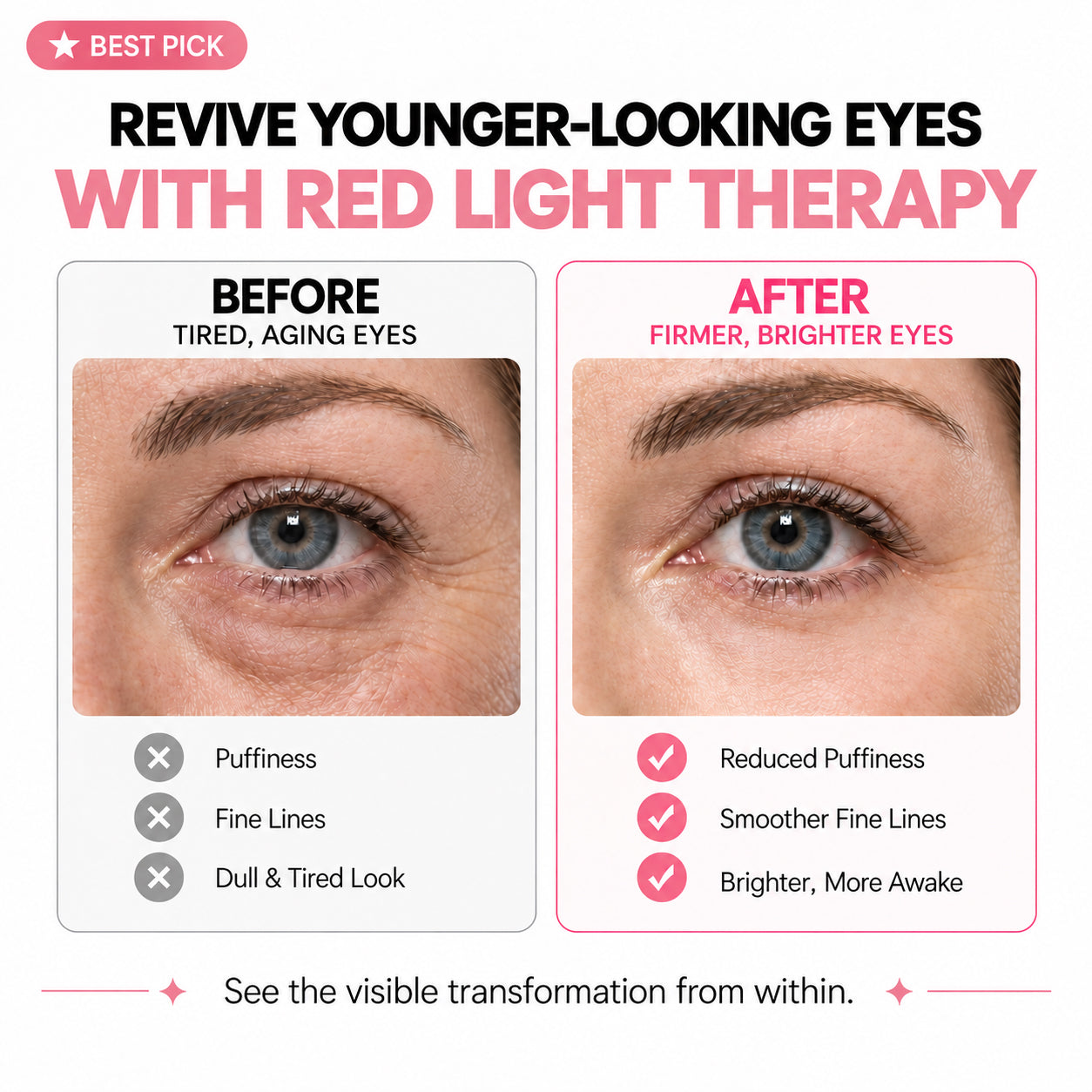 2-in-1 Red Light Therapy + EMS To Erase Eye Bags