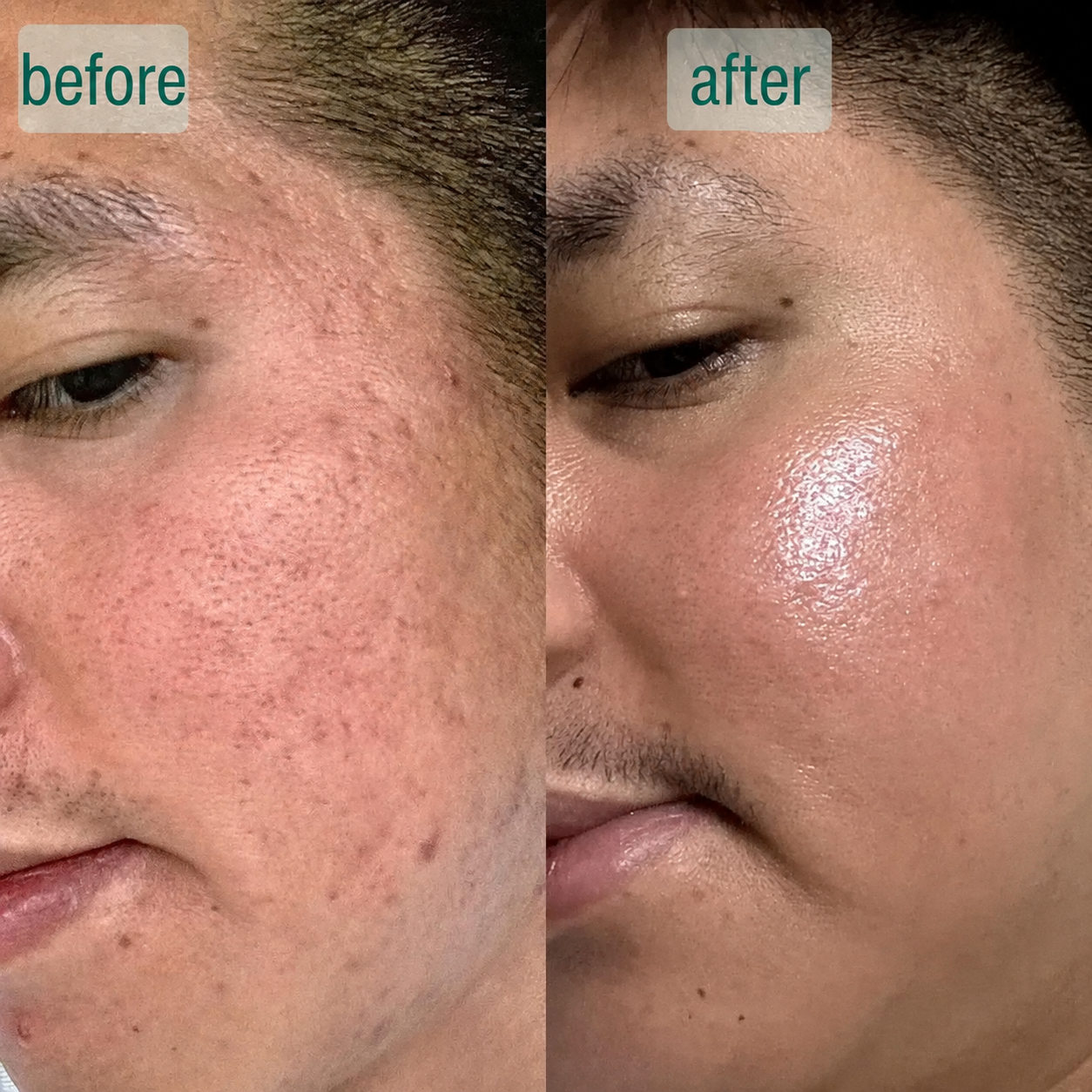 Microcrystal™ Serum PM Duo