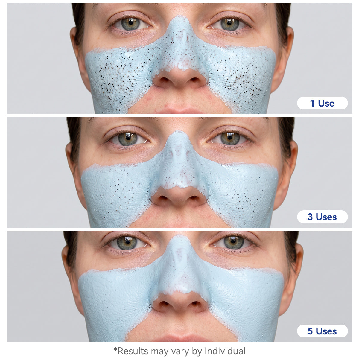 Medicube Zero Pore Blackhead Mud Mask clinical study results — blackhead, sebum, and pore waste reduction
