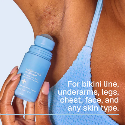 Tryskintle: Smoothing Solution For Ingrown Hairs