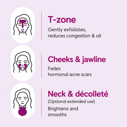 Arbutin 7% + Tranexamic Acid 4% Cream