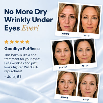 Tryskintle- Korean Under Eye Balm