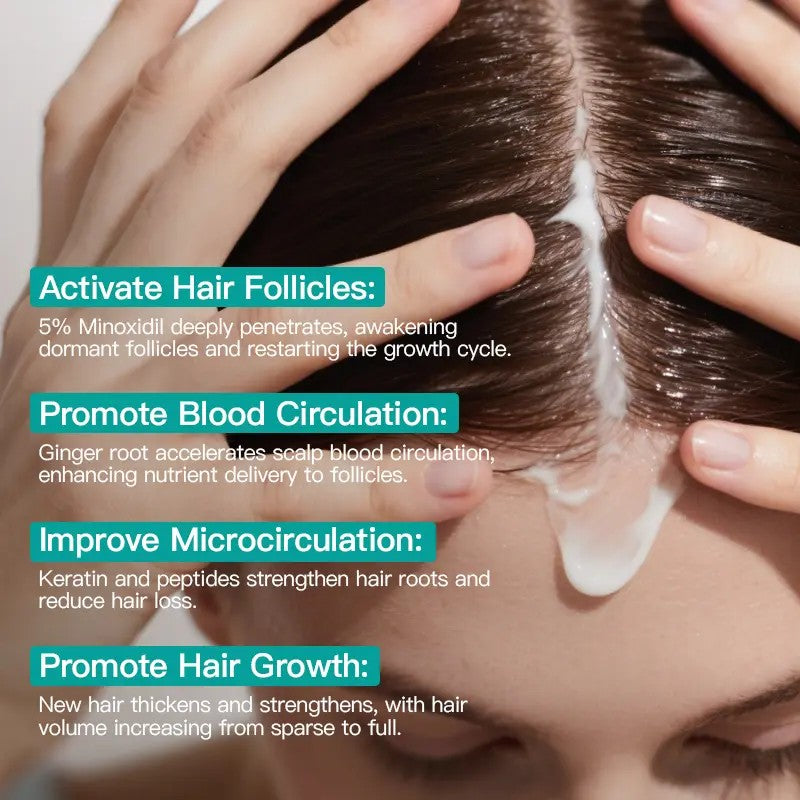 tryskintle 5% Minoxidil Hair Growth Cream