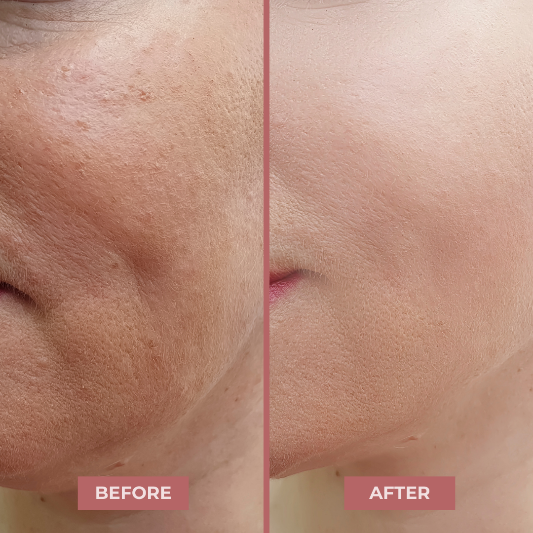 NAD+ Peptide Boosting Serum