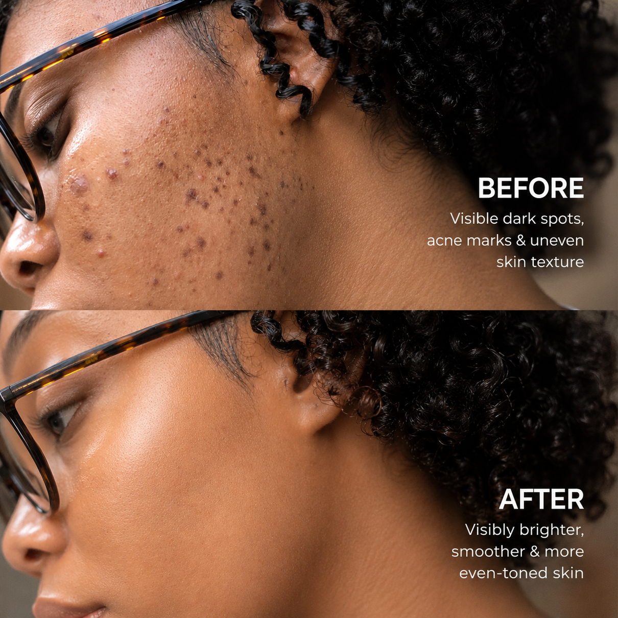 Korean Advanced Tranexamic Acid Brightening Cream