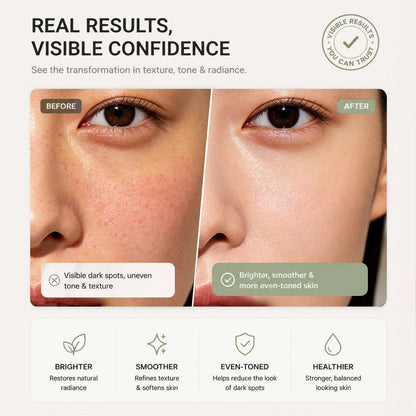 Korean Advanced Tranexamic Acid Brightening Cream