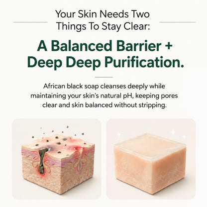 Pure Nilotica Shea Butter by Tryskintle™