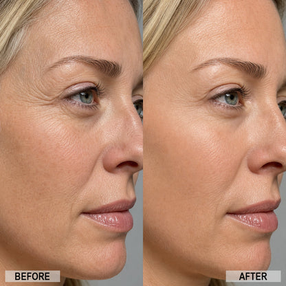 Power Redo Wrinkle Fix