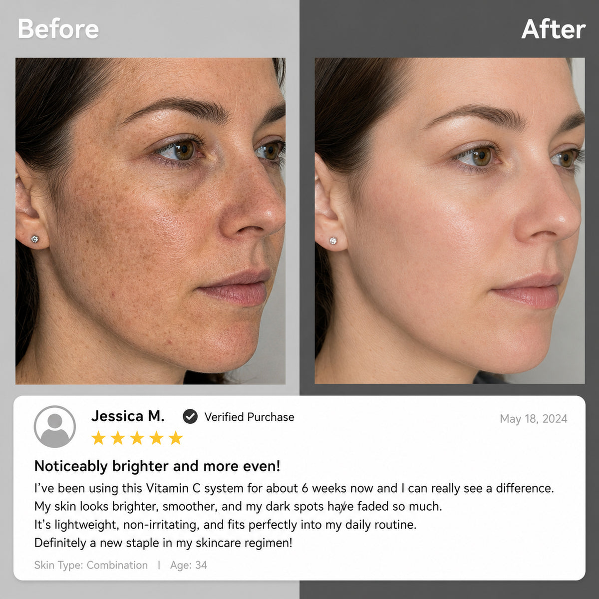 Dual Chamber Vitamin C Skincare Cream