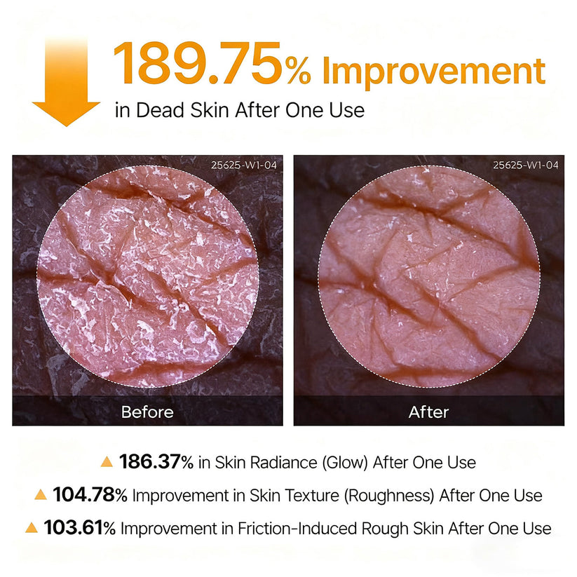 Tryskintle Peel Shot - Kojic + Turmeric Body Peel Spray
