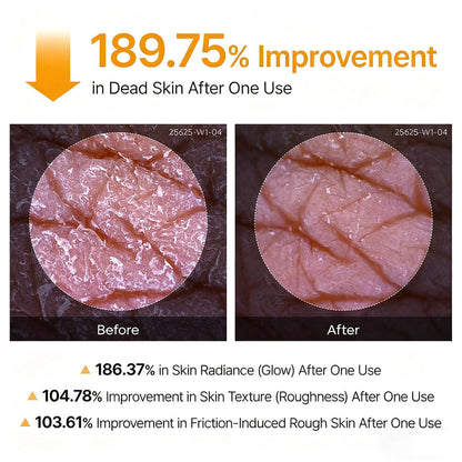 Tryskintle Peel Shot - Kojic + Turmeric Body Peel Spray