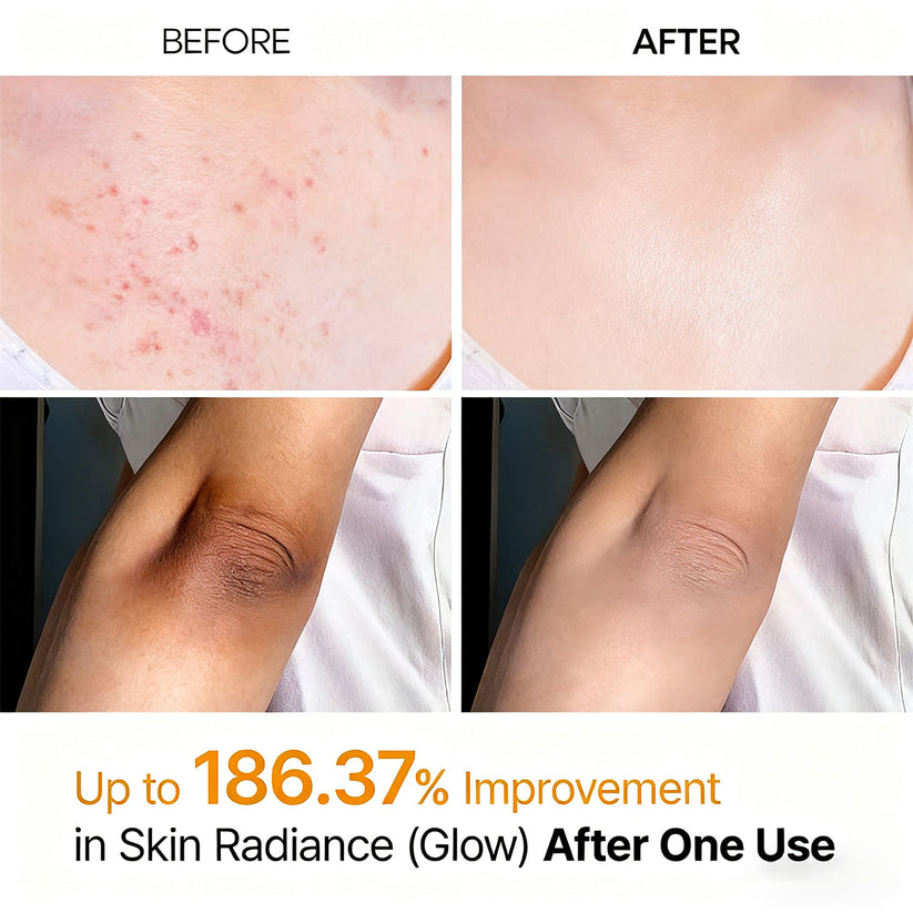 Tryskintle Peel Shot - Kojic + Turmeric Body Peel Spray