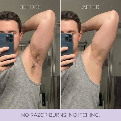 Tryskintle Hair Removal Mousse