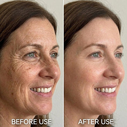 tryskintle Face Serum