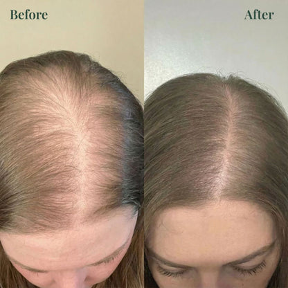 Vitaliaina™ Growth-Support Shampoo
