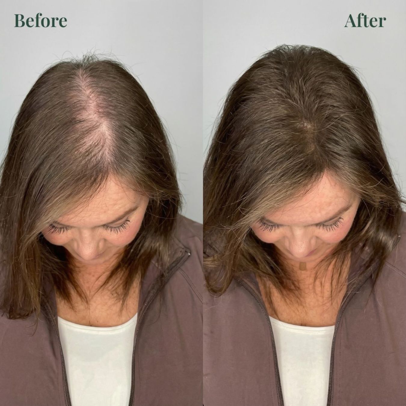 Vitaliaina™ Growth-Support Shampoo