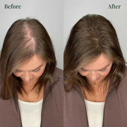 Vitaliaina™ Growth-Support Shampoo