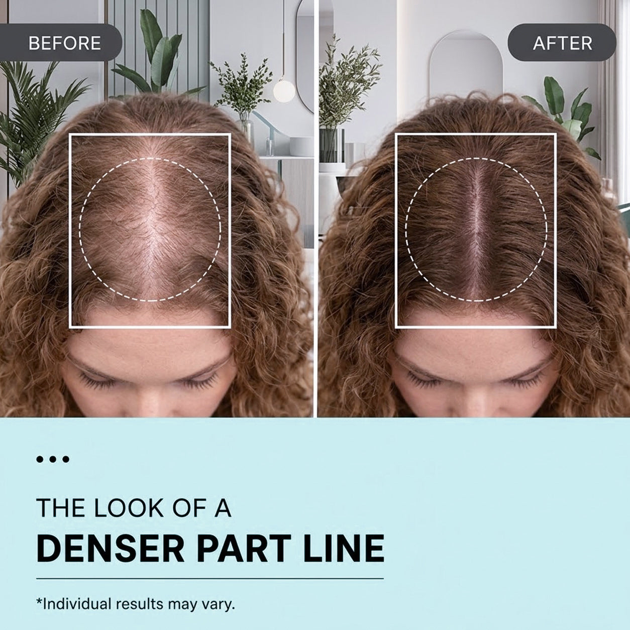 PDRN Reedle Shot Hair Brush Serum