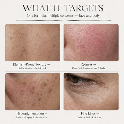 Azelaic Acid 14% + Retinol Smoothing Cream—Uneven Tone, Fine Lines & Rough Texture