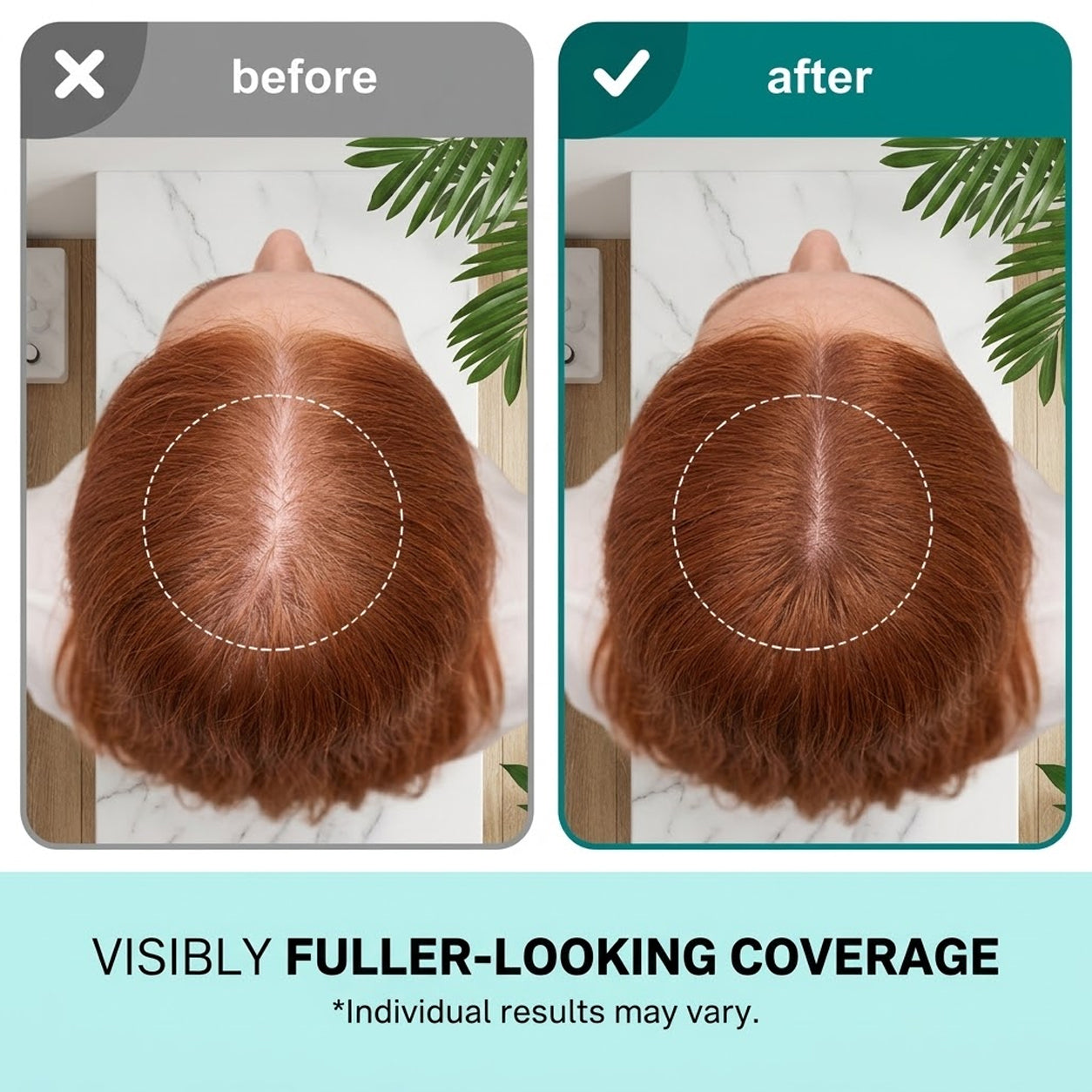 PDRN Reedle Shot Hair Brush Serum