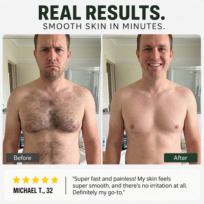 tryskintle  Hair Removal Cream