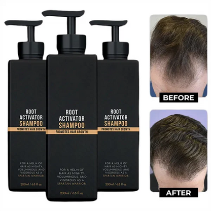 tryskintle Root Activator Shampoo