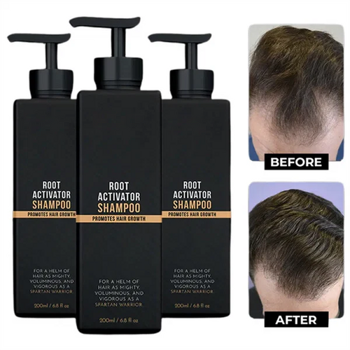 tryskintle Root Activator Shampoo