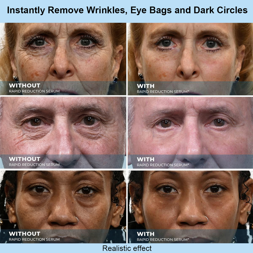 Tryskintle™ Instant Face Temporary Tightener – Instant visible results in 30 seconds