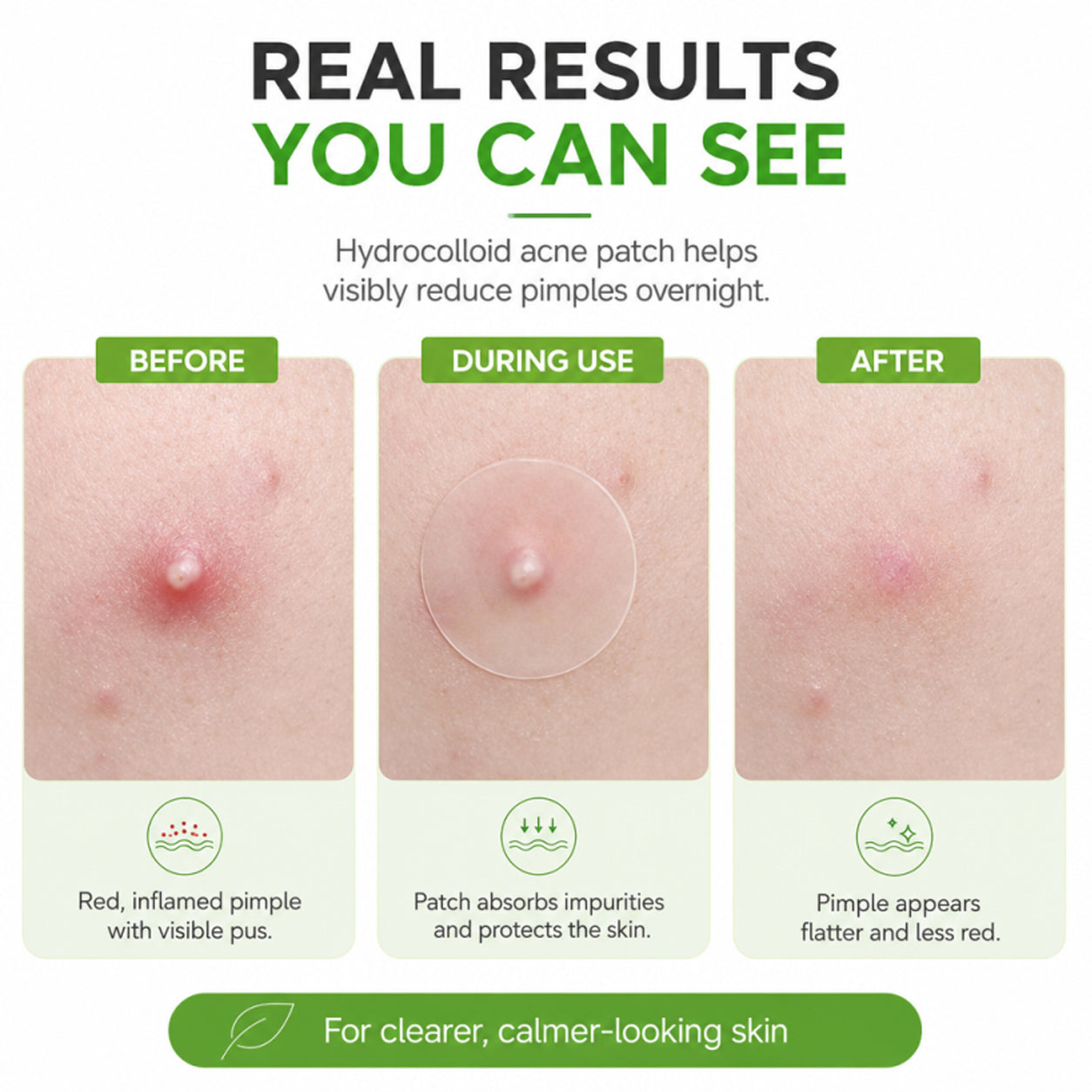 Zero Fit Blemish & Dark Spot Patch Duo