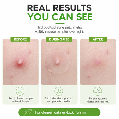 Zero Fit Blemish & Dark Spot Patch Duo