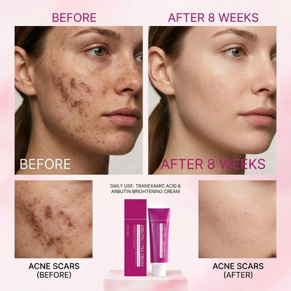 ✨ Tranexamic Acid Brightening Cream