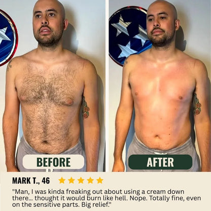 tryskintle  Hair Removal Cream