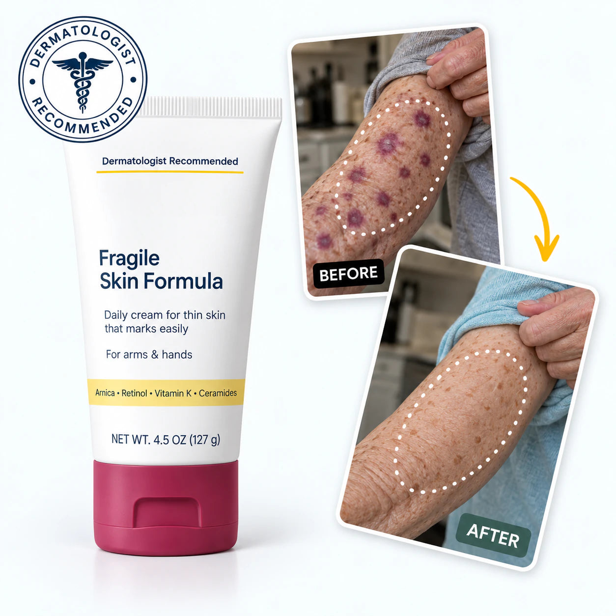  tryskintle  Fragile Skin Formula with before-and-after forearm imagery