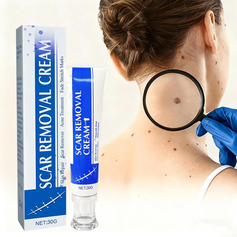 Tryskintle Scar Removal Cream