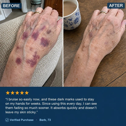 Fragile Skin Formula