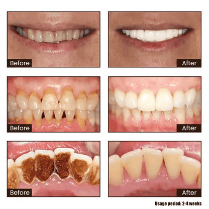 New 7-Pro Intensive Toothpaste | Upgraded Purple Formula with 7 Probiotics | Deep Enamel Repair & Long-Lasting Freshness#dealsforyoudays