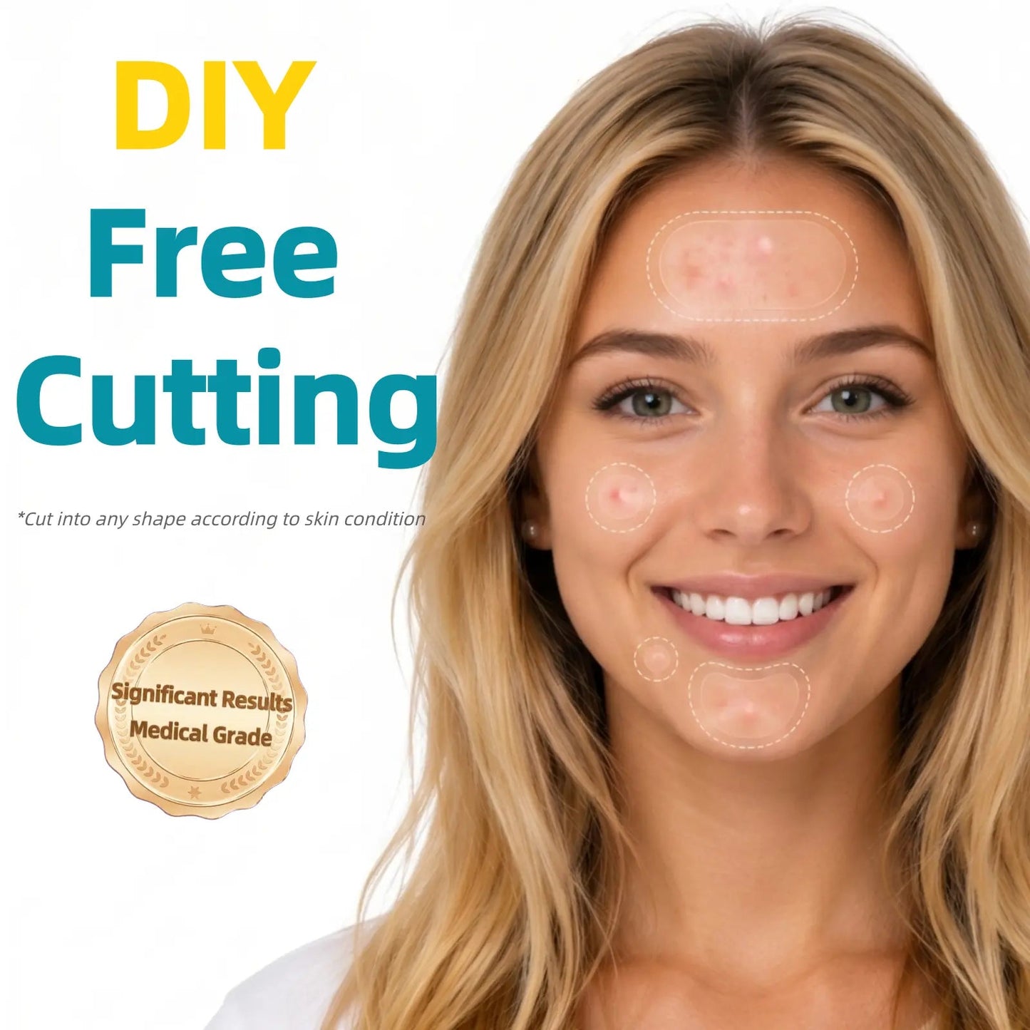 Hydrocolloid Acne Patch Roll – Cut to Any Size, 2 in × 16 ft