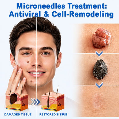 2-in-1 Microneedle & Hydrocolloid Patch 🌿 Invisible Face & Body Patches for Raised Moles, Acne, Flat Warts & Skin Tags - Helps Improve the Appearance of Wrinkles, Scars & Blemishes