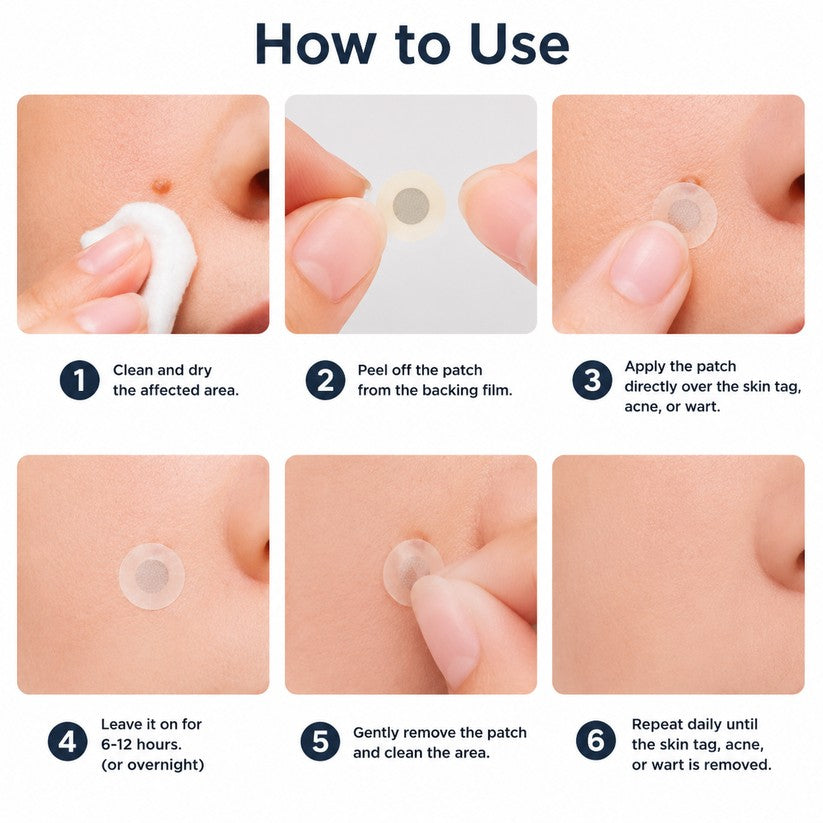 2-in-1 Microneedle & Hydrocolloid Patch 🌿 Invisible Face & Body Patches for Raised Moles, Acne, Flat Warts & Skin Tags - Helps Improve the Appearance of Wrinkles, Scars & Blemishes